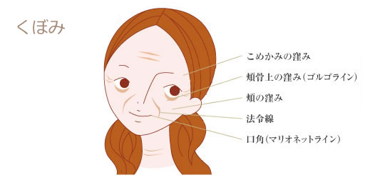 顔のしわ・くぼみ