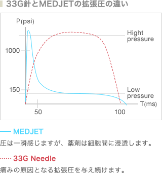 33Gとメドジェットの拡張圧の比較